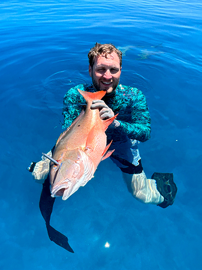 James C. Hazlett, DDS | Dentures, Dental Fillings and Teeth Whitening