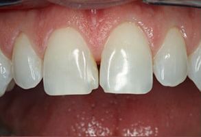 James C. Hazlett, DDS | Oral Cancer Screening, Emergency Treatment and Teeth Whitening